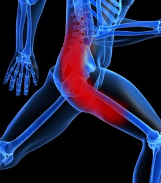 sciatica leg pain
